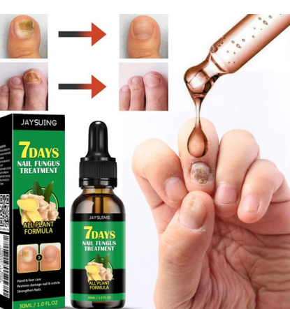 7 DAYS TRATAMIENTO PARA HONGOS UÑAS PIES Y MANOS (30 ML)